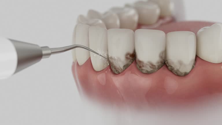 Reliable Dental contractor in Chillicothe, MO by Dentist Open Now